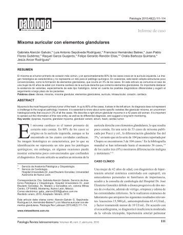 Mixoma Auricular Pdf